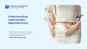 Laparoscopic Appendectomy In Dubai
