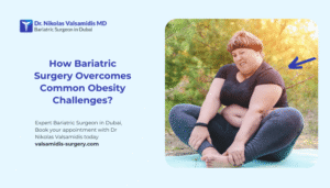 Common Obesity Challenges