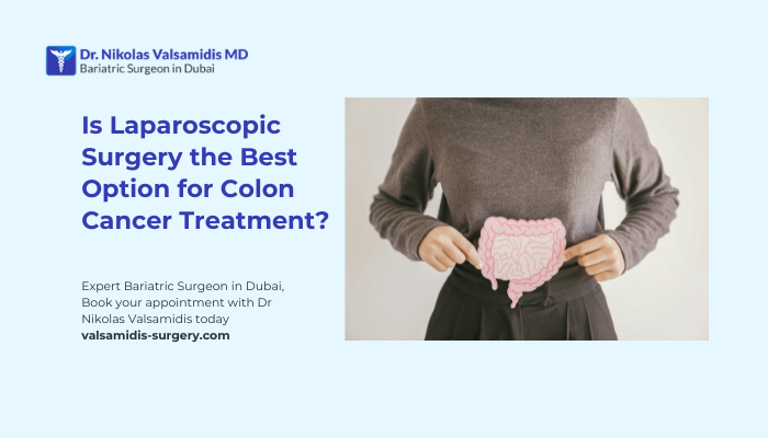 Best Option for Colon Cancer Treatment