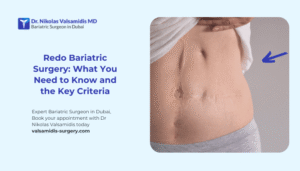 Redo Bariatric Surgery in Dubai