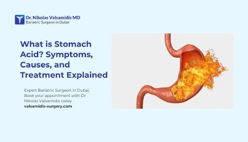 What is Stomach Acid