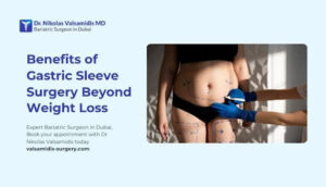 Benefits of Gastric Sleeve Surgery