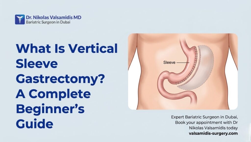 What Is Vertical Sleeve Gastrectomy A Complete Beginner’s Guide