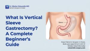 What Is Vertical Sleeve Gastrectomy A Complete Beginner’s Guide