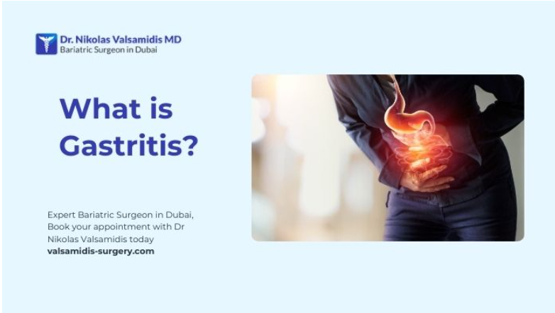1what is gastritis