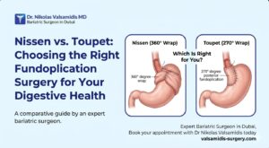 1Nissen vs Toupet Choosing the Right Fundoplication Surgery for Your Digestive Health nikolas