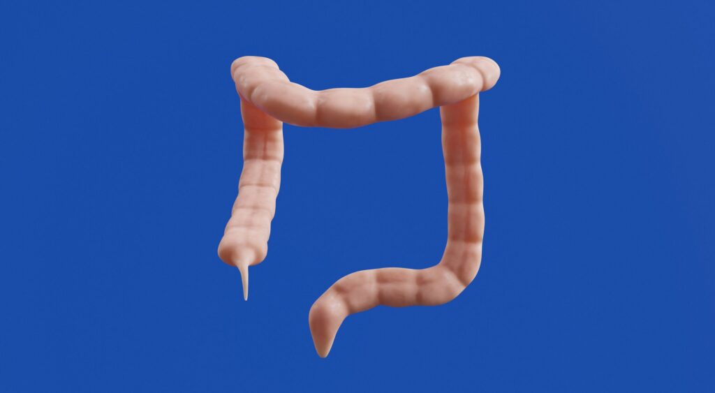 1Top 10 Common Inguinal Hernia Symptoms