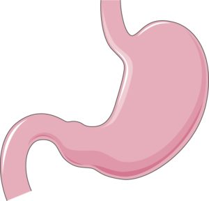nikolas Gastric Sleeve Surgery In Dubai