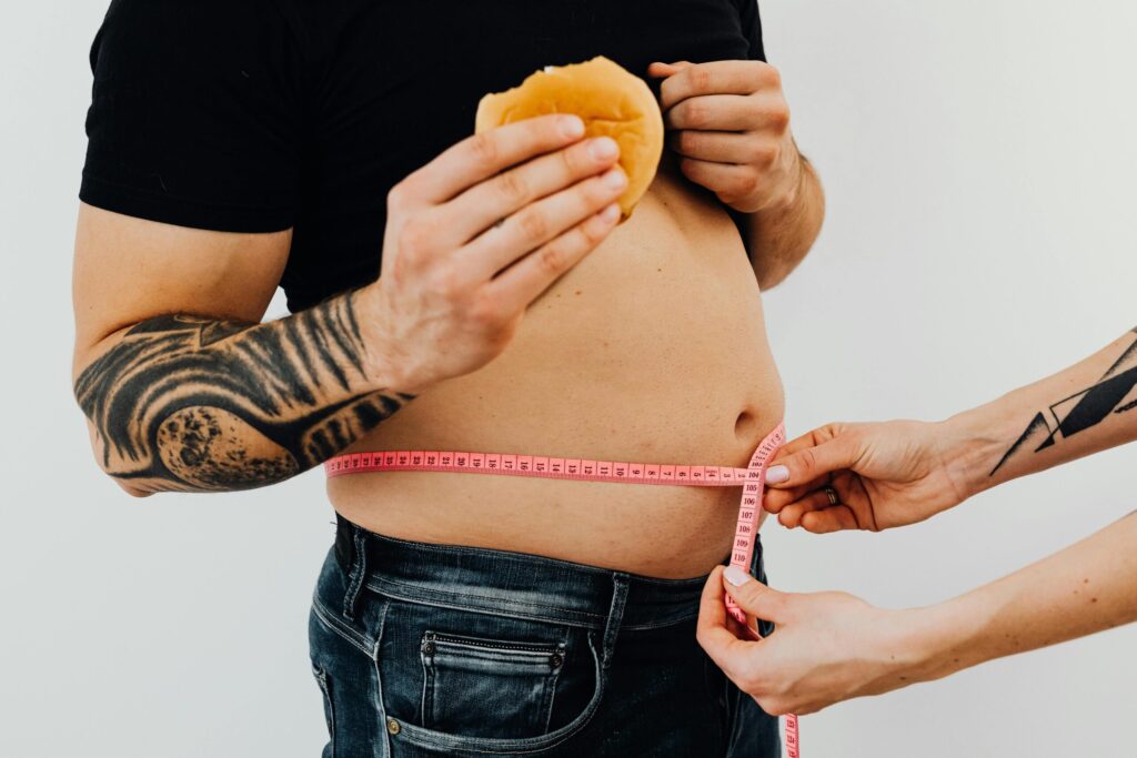 nikolas Permanent Laparoscopic Weight Loss In Dubai