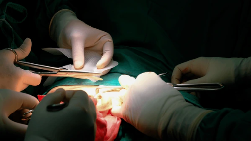 incisional hernia 2