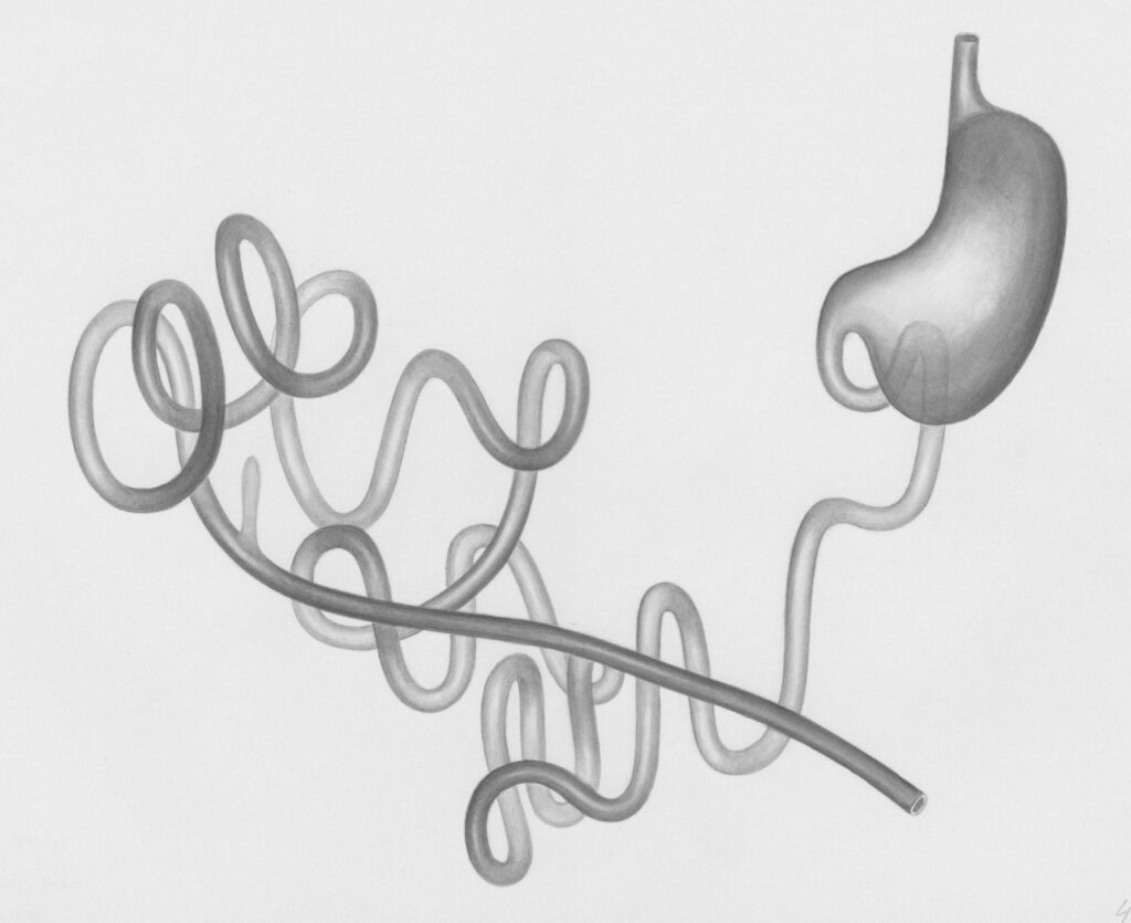 upper gastrointestinal (GI) tract